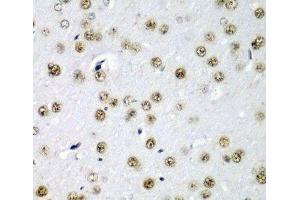 Immunohistochemistry of paraffin-embedded Rat brain using SF3B3 Polyclonal Antibody at dilution of 1:200 (40x lens). (SF3B3 antibody)