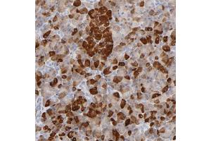 Immunohistochemical staining of human pancreas with RPLP1 polyclonal antibody  shows strong cytoplasmic positivity in exocrine glandular cells at 1:200-1:500 dilution. (RPLP1 antibody)