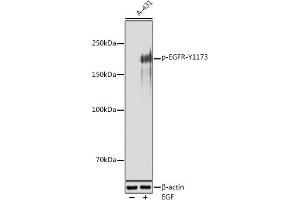 Western blot analysis of extracts of A-431 cells, using Phospho-EGFR-Y1173 antibody (ABIN7266990) at 1:500 dilution. (EGFR antibody  (pTyr1173))