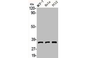 Western Blot analysis of MCF7 HELA PC12 cells using Adenosine A3-R Polyclonal Antibody (Adenosine A3 Receptor antibody  (C-Term))