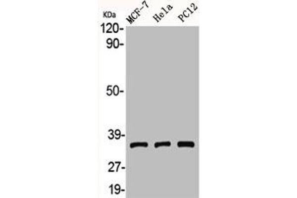 Adenosine A3 Receptor 抗体  (C-Term)