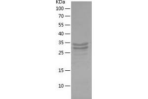 Western Blotting (WB) image for Galanin-Like Peptide (GALP) (AA 25-84) protein (His-IF2DI Tag) (ABIN7282269) (GALP Protein (AA 25-84) (His-IF2DI Tag))