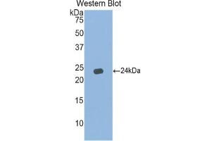 Western blot analysis of the recombinant protein. (IFNA5 antibody  (AA 24-189))