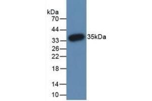 Western Blotting (WB) image for anti-Peptidyl Arginine Deiminase, Type III (PADI3) (AA 1-300) antibody (ABIN7427774)