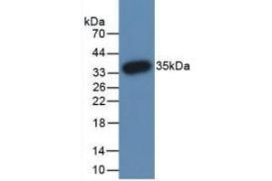 Detection of Recombinant PADI3, Human using Monoclonal Antibody to Peptidyl Arginine Deiminase Type III (PADI3) (PADI3 antibody  (AA 1-300))