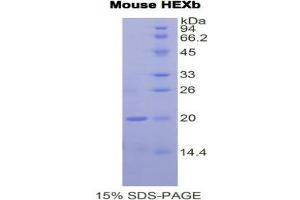 SDS-PAGE (SDS) image for Hexosaminidase B (Beta Polypeptide) (HEXB) (AA 294-435) protein (His tag) (ABIN1877986) (HEXB Protein (AA 294-435) (His tag))