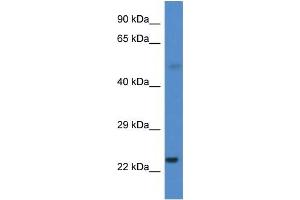 CYP1B1 antibody used at 0. (CYP1B1 antibody  (Middle Region))