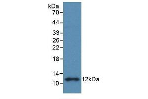 Detection of Recombinant S100B, Rat using Monoclonal Antibody to S100 Calcium Binding Protein B (S100B) (S100B antibody  (AA 1-92))