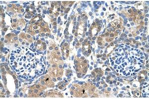 Human kidney (MTA2 antibody  (C-Term))