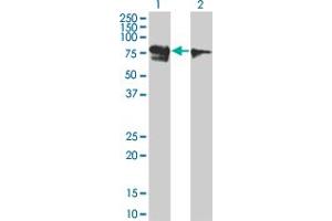 Western Blot analysis of RUNX1T1 expression in transfected 293T cell line by RUNX1T1 monoclonal antibody (M01), clone 5A12.
