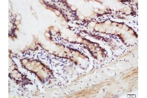 Formalin-fixed and paraffin embedded mouse intestine labeled with Rabbit Anti-CRNKL1 Polyclonal Antibody, Unconjugated  at 1:200 followed by conjugation to the secondary antibody and DAB staining. (CRNKL1 antibody  (AA 201-300))