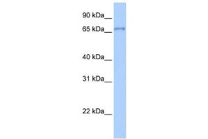 Western Blotting (WB) image for anti-Zinc Finger Protein 76 (Expressed in Testis) (ZNF76) antibody (ABIN2458032) (ZNF76 antibody)