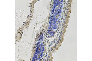 Immunohistochemistry of paraffin-embedded mouse lung using INHBB antibody (ABIN5995978) at dilution of 1/100 (40x lens).