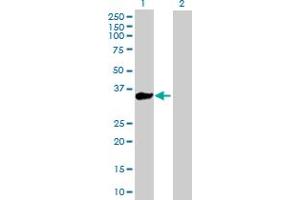 Western Blot analysis of KLHL3 expression in transfected 293T cell line by KLHL3 MaxPab polyclonal antibody. (KLHL3 antibody  (AA 1-301))