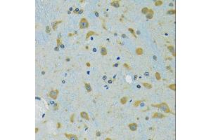 Immunohistochemistry of paraffin-embedded mouse brain using RPS7 antibody (ABIN5974069) at dilution of 1/100 (40x lens). (RPS7 antibody)