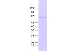 Western Blotting (WB) image for Differentially Expressed in FDCP 8 Homolog (DEF8) protein (His tag) (ABIN2719346)