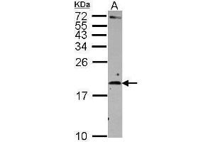 WB Image Sample (30 ug of whole cell lysate) A: Raji 15% SDS PAGE antibody diluted at 1:500 (IL-2 antibody)