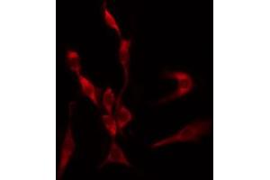 ABIN6267662 staining HeLa by IF/ICC. (LKB1 antibody  (pSer428))