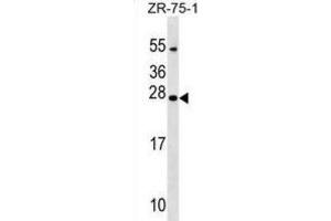 Western Blotting (WB) image for anti-Nucleoredoxin Like Protein 1 (NXNL1) antibody (ABIN2999692) (NXNL1 antibody)