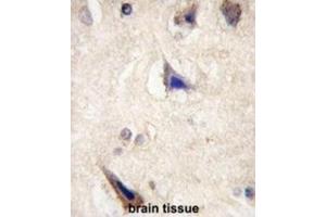 Immunohistochemistry (IHC) image for anti-Leucine-Rich Repeat Containing G Protein-Coupled Receptor 5 (LGR5) (Loop 1) antibody (ABIN3001605) (LGR5 antibody  (Loop 1))