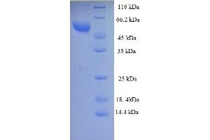 SDS-PAGE (SDS) image for Zona Pellucida Glycoprotein 3 (ZP3) (AA 23-346), (partial) protein (GST tag) (ABIN5712926) (Zona Pellucida Glycoprotein 3 Protein (ZP3) (AA 23-346, partial) (GST tag))