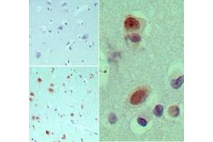 Image no. 1 for anti-Eukaryotic Translation Initiation Factor 3, Subunit G (EIF3G) (AA 50-100) antibody (ABIN960153) (EIF3G antibody  (AA 50-100))