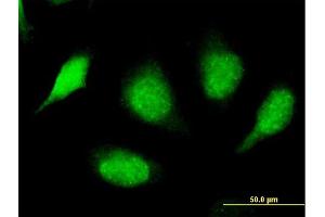 Immunofluorescence of purified MaxPab antibody to SPSB3 on HeLa cell. (SPSB3 antibody  (AA 1-355))