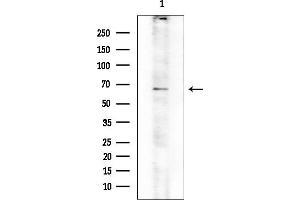 anti-Caspase Recruitment Domain Family, Member 9 (CARD9) (C-Term) antibody