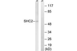 Western blot analysis of extracts from Jurkat cells, using SHC2 Antibody. (SHC2 antibody  (AA 261-310))