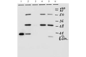 IP analysis of HPV-18 E7 protein. (HPV18 E7 antibody  (AA 1-35))