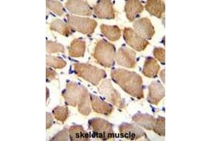 ARL17P1 Antibody (Center) immunohistochemistry analysis in formalin fixed and paraffin embedded human skeletal muscle followed by peroxidase conjugation of the secondary antibody and DAB staining. (ARL17A antibody  (Middle Region))