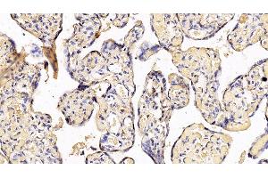 Immunohistochemistry (IHC) image for anti-Interferon alpha/beta Receptor 2 (IFNAR2) (AA 27-243) antibody (ABIN7435736)