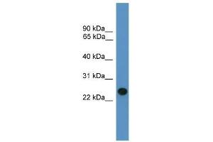 Western Blot showing BNIP1 antibody used at a concentration of 1-2 ug/ml to detect its target protein. (BNIP1 antibody  (C-Term))