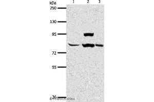 Western blot analysis of Human liver cancer tissue, hela cell and mouse lung tissue, using AGAP1 Polyclonal Antibody at dilution of 1:400 (AGAP1 antibody)