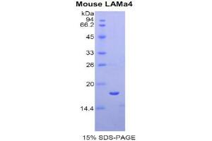 SDS-PAGE (SDS) image for Laminin, alpha 4 (LAMa4) (AA 102-234) protein (His tag) (ABIN2121517)