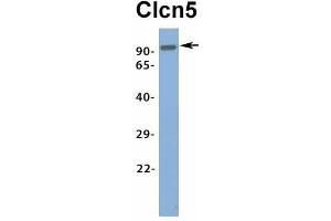 Host:  Rabbit  Target Name:  Clcn5  Sample Type:  Rat Brain  Antibody Dilution:  1. (Chloride Channel 5 antibody  (Middle Region))