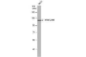 WB Image NFkB p100 antibody [C2C3], C-term detects NFkB p100 protein by western blot analysis. (NFKB2 antibody  (C-Term))