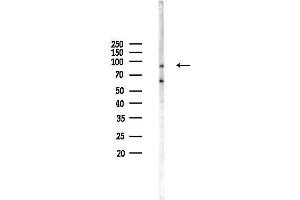 Western blot analysis of lysates from COLO205 cells(heat-shock,45 min treatment), using DIEXF Antibody at 1/1000 dilution.