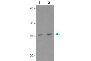 Western blot analysis of NDFIP1 in PC-3 cell lysate with NDFIP1 polyclonal antibody  at (1) 0. (NDFIP1 antibody  (N-Term))