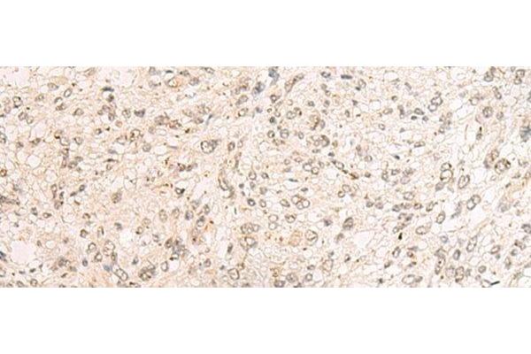 PAF1/PD2 antibody