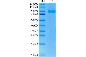 Rat XPNPEP2 on Tris-Bis PAGE under reduced condition. (XPNPEP2 Protein (AA 23-650) (His tag))