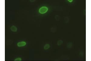 Immunofluorescence (IF) image for anti-DNA Fragmentation Factor, 45kDa, alpha Polypeptide (DFFA) (AA 1-331) antibody (ABIN2719431)