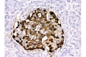 Anti- GLP1 Picoband antibody, IHC(P) IHC(P): Human Pancreatic Cancer Tissue (Glucagon antibody  (N-Term))