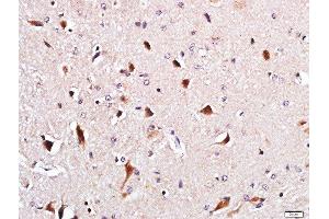 Paraformaldehyde-fixed, paraffin embedded mouse brain, Antigen retrieval by boiling in sodium citrate buffer (pH6) for 15min, Block endogenous peroxidase by 3% hydrogen peroxide for 30 minutes, Blocking buffer (normal goat serum) at 37°C for 20min, Antibody incubation with POU3F4 Polyclonal Antibody, Unconjugated  at 1:500 overnight at 4°C, followed by a conjugated secondary and DAB staining. (POU3F4 antibody  (AA 211-320))