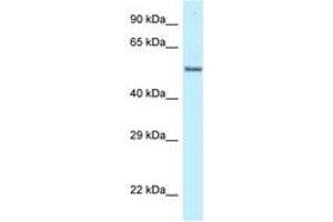 Image no. 1 for anti-Zinc Finger Protein 384 (ZNF384) (C-Term) antibody (ABIN6747728) (ZNF384 antibody  (C-Term))