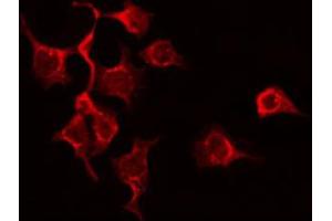 ABIN6272355 staining Hela by IF/ICC. (L1CAM antibody  (C-Term))