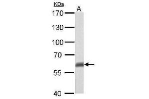 Western Blotting (WB) image for anti-Tumor Protein P63 (TP63) antibody (ABIN2855394)