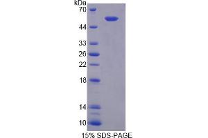 Image no. 1 for Gap Junction Protein, alpha 4, 37kDa (GJA4) (AA 19-245) protein (His tag,GST tag) (ABIN6238485) (GJA4 Protein (AA 19-245) (His tag,GST tag))