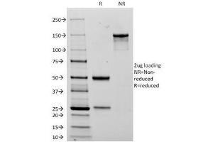 SDS-PAGE Analysis of Purified, BSA-Free NCAM Antibody (clone 123C3. (CD56 antibody)
