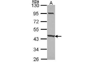WB Image Sample (30 ug of whole cell lysate) A: JurKat 10% SDS PAGE CCDC83 antibody antibody diluted at 1:1000 (CCDC83 antibody)